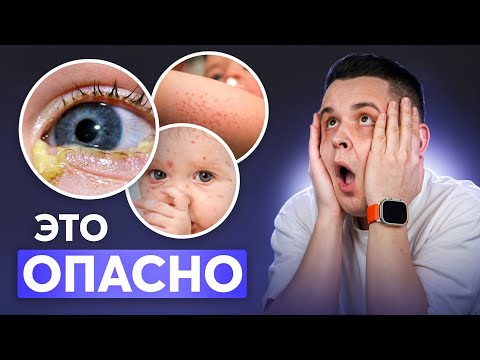 Видео: ВАЖНО ЗНАТЬ ВСЕМ! 12 Самых ОПАСНЫХ инфекций у младенцев