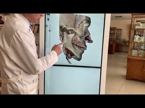 Видео: мышцы 8 - Бас бұлшықеттері   шайнау бұлшықеттері