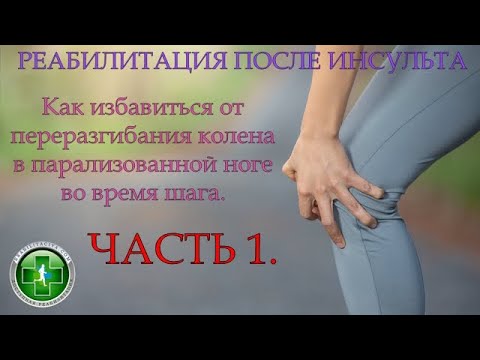 Видео: Как избавиться от переразгибания в колене парализованной ноги при ходьбе после инсульта.