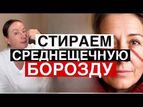 Видео: Стираем СРЕДНЕ ЩЕЧНУЮ БОРОЗДУ 