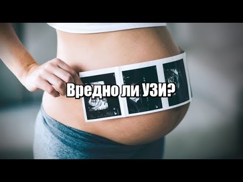 Видео: Вредно ли УЗИ при беременности, как часто можно делать УЗИ?