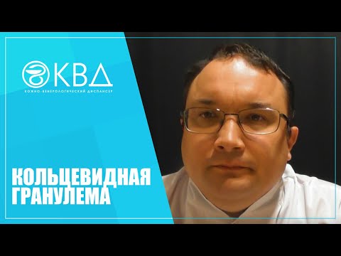 Видео: 1384  Кольцевидная гранулема