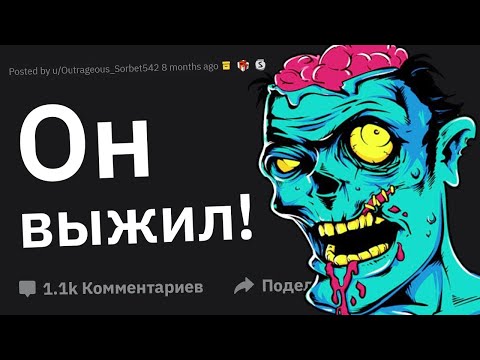 Видео: Врачи, Когда Вы Думали Что Пациент Не Выживет, Но Он Выжил?