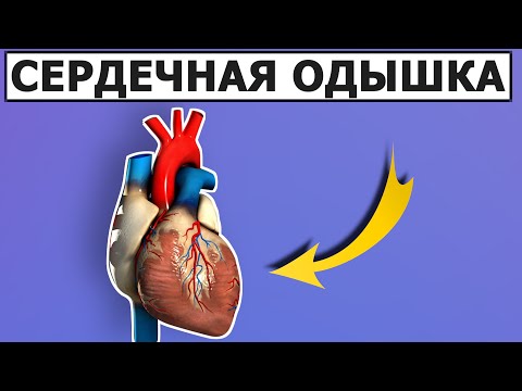 Видео: Избавьтесь от этих причин и сердечная одышка пройдет