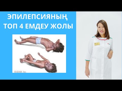 Видео: Эпилепсияны қалай емдеуге болады? ТОП 4 ЕМДЕУ ЖОЛЫ