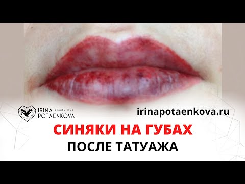 Видео: Синяки на губах после татуажа? Почему?