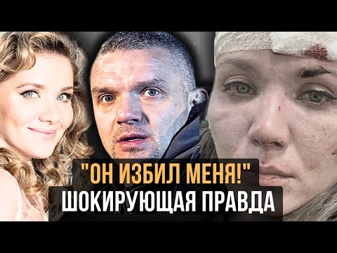 Видео: От предательства с подругой до шрама на лице – вся правда о токсичном браке Епифанцева и Веденской!