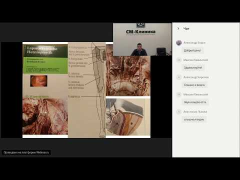 Видео: Вебинар Паховая грыжа  Часть2