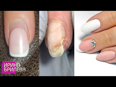 Видео: Tрэш!!! 💅 ХИТРОСТЬ и онихолизис 💅 РЕМОНТ ногтя и свадебный МАНИКЮР