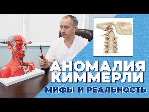 Видео: Аномалия Киммерли. Что это? Как лечить?