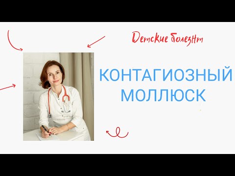 Видео: Контагиозный моллюск! Что это? Почему ребёнок страдает? Как лечить? Особенности течения при АтД