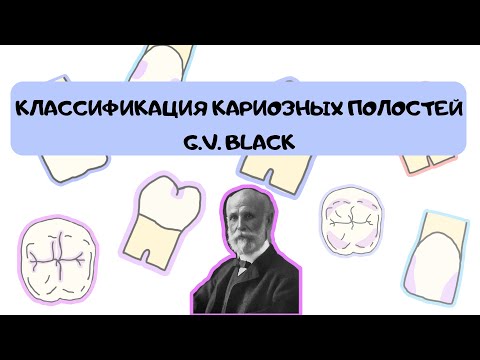 Видео: Классификация кариозных полостей Г.В. Блэк| G.V. Black