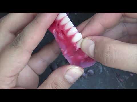 Видео: Постановка нижних задних зубов