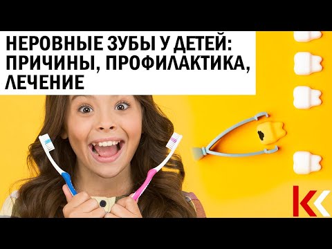 Видео: Неровные зубы у детей: причины, профилактика, лечение.
