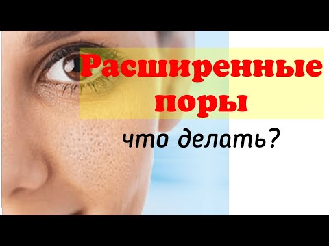 Видео: Расширенные поры: что делать? Как сузить и убрать черные точки эффективно?