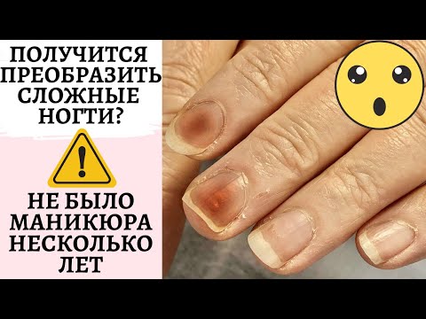Видео: Получится ли преображение ногтей? 🙌🏻