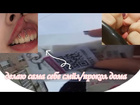 Видео: делаю себе смайл дома❄️/ сама себе проколола🎄/ в 13 лет