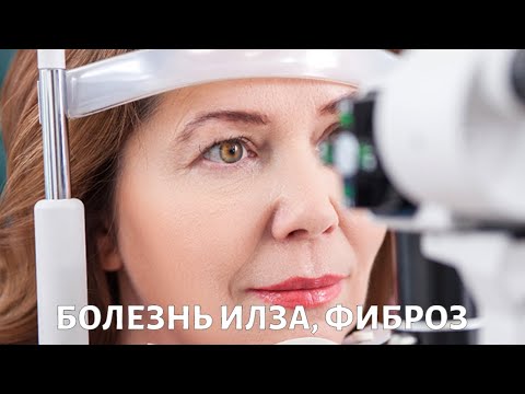 Видео: Болезнь Илза и эпиретинальный фиброз: как сохранить зрение?