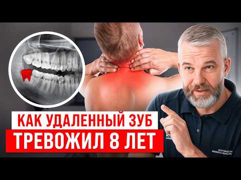 Видео: ЭТО ШОК! 8 лет боли после удаления зуба. Боль в шее прошла за 5 минут!