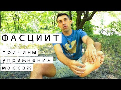 Видео: Плантарный фасциит. Личный опыт