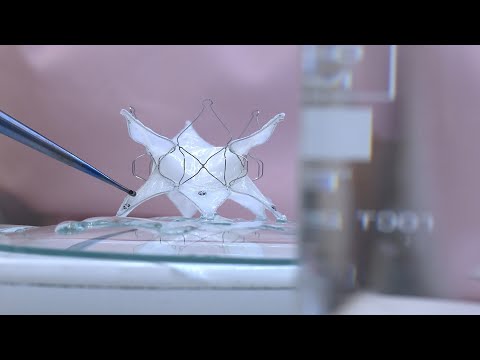 Видео: Биопротез митрального клапана разработали в НМИЦ им. Е.Н.Мешалкина