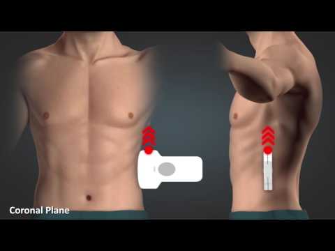 Видео: Clarius: Основы ультразвука 2 (оборудование и применение)