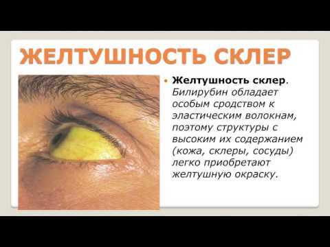 Видео: Вирусные гепатиты A, E. Е.П.Тихонова.