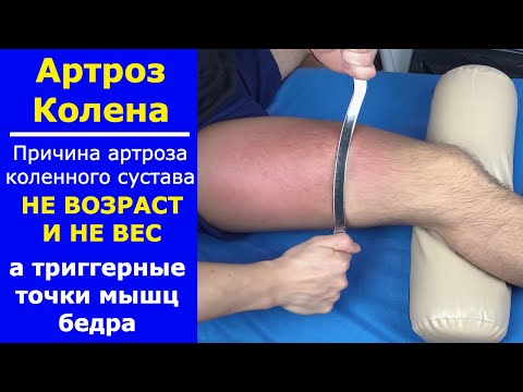Видео: Артроз коленного сустава. Самолечение и самомассаж.