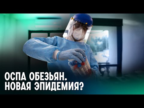 Видео: Оспа обезьян: насколько опасна, как не заразиться, чем лечить