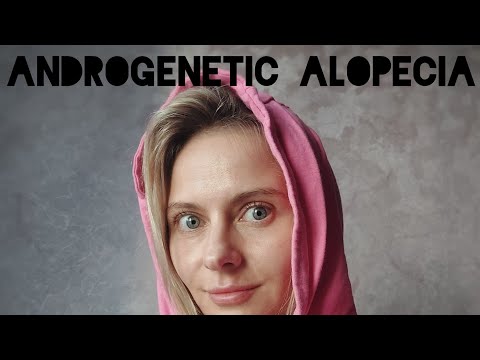 Видео: Андрогенная алопеция. Миноксидил. 5 месяцев без гормонов.