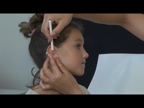 Видео: КОРРЕКЦИЯ ФОРМЫ УШЕЙ – НА ЧТО СПОСОБНА ОТОПЛАСТИКА?