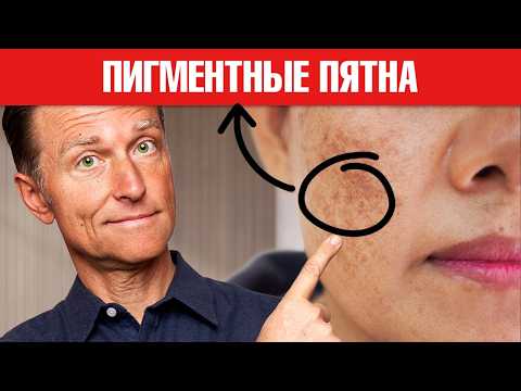 Видео: Дефицит ЭТОГО минерала вызывает возрастные пигментные пятна 🧐