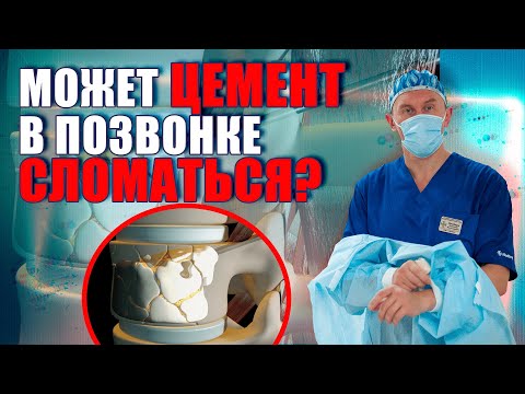 Видео: Обзор цемента для вертебропластики позвоночника! Нейрохирург