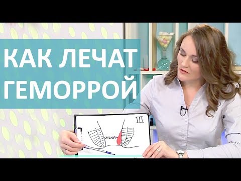 Видео: ЧТО ТАКОЕ ГЕМОРРОЙ