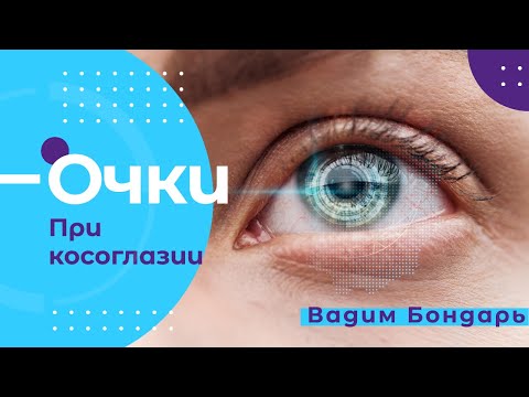 Видео: Как помогают  очки при косоглазии?  Рефлекс на близь.