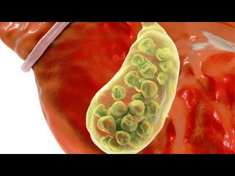 Видео: ӨТТЕ ТАС БОЛУЫНЫҢ 5 БЕЛГІСІ . ҚАЛАЙ ТҮСІРУГЕ БОЛАДЫ?