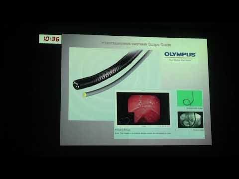 Видео: 3 Дуванский В.А.  Повторная колоноскопия  Кому? Когда?