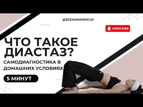 Видео: что такое диастаз? диагностика в домашних условиях 