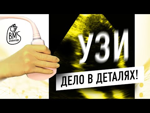 Видео: УЗИ: дело в деталях! Физика ультразвука и применение современных методов ультразвуковой диагностики