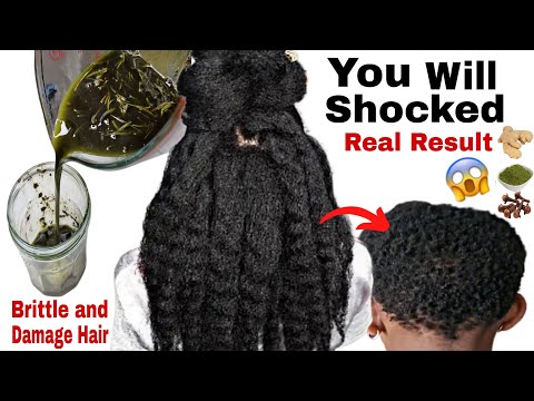 Видео: БЕЗ ШУТКИ! Средство для роста волос за ночь! Как я БЫСТРО отрастил волосы с помощью гвоздики, мор...