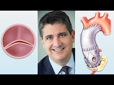 Видео: Вопросы и ответы хирурга: преимущества замены двустворчатого аортального клапана и клапана с сохр...