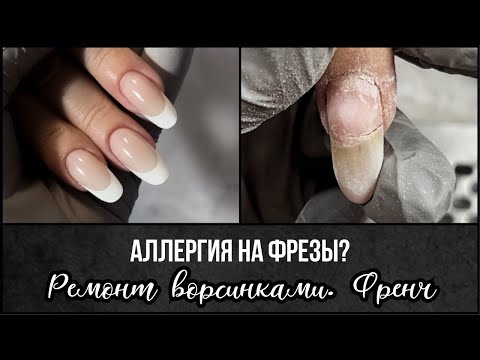 Видео: Аллергия на фрезы и пилки?? Ремонт трещины ворсинками. Поднятие клюющих ногтей. Френч