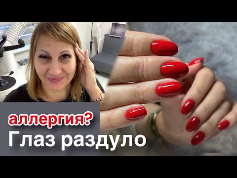 Видео: Жуткая аллергия на гель лак? Отёк глаз. Чуть клиентку без маникюра не оставила.