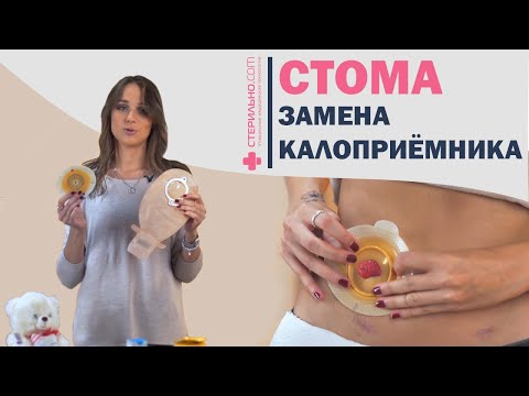 Видео: Как заменить двухкомпонентный калоприемник для стомы?   | Стерильно.com