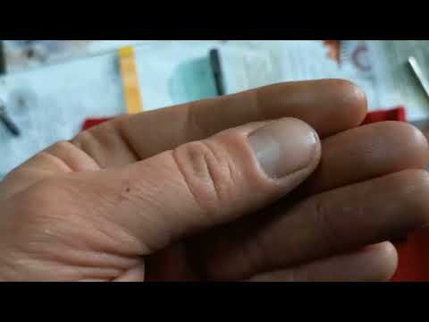 Видео: Ремонт форсунок КИА Соренто 2.5 дизель.