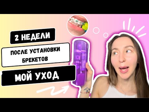 Видео: МОЙ УХОД ЗА БРЕКЕТАМИ 🧺🧼: какими средствами пользуюсь/две недели после установки брекетов