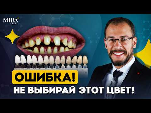 Видео: Зубы будут выглядеть ЕСТЕСТВЕННО! Как выбрать Форму и Цвет Виниров!
