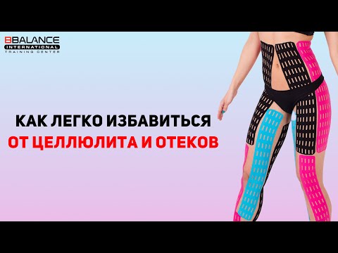 Видео: КАК УБРАТЬ ЦЕЛЛЮЛИТ И ОТЕКИ В ДОМАШНИХ УСЛОВИЯХ? | Эстетическое тейпирование
