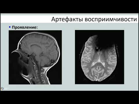 Видео: Артефакты и способы борьбы с ними