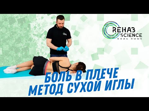 Видео: Дельтовидная мышца на боку. Сухие иглы